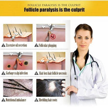 Load image into Gallery viewer, 7 Day Hair Growth Serum